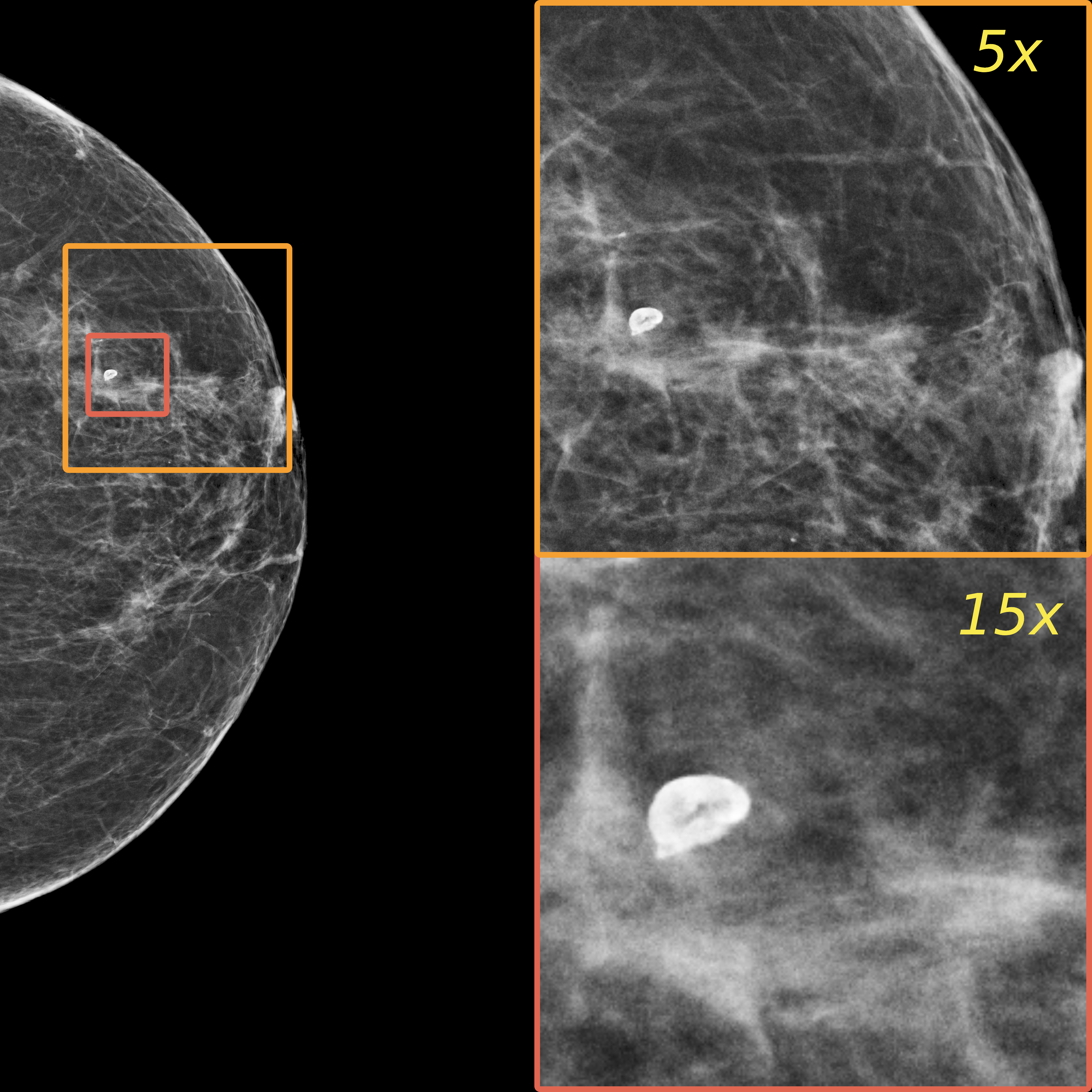 MAMBO synthetic 3840x3840 mammogram