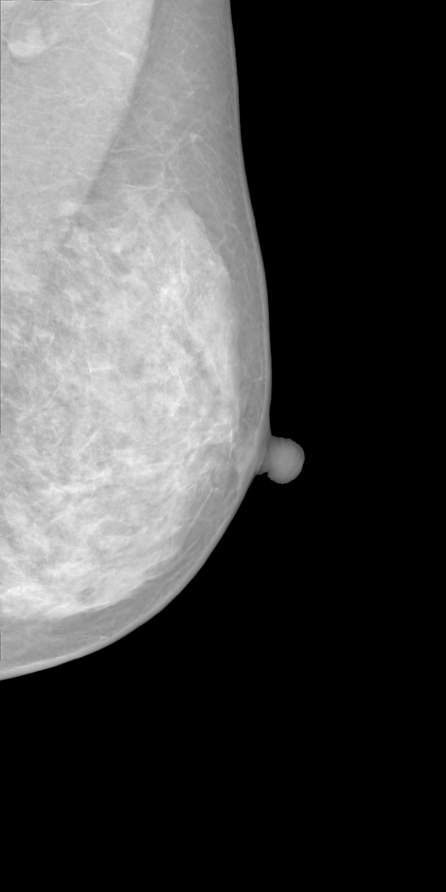 Right synthetic mammogram